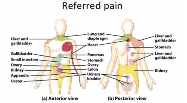 referred pain